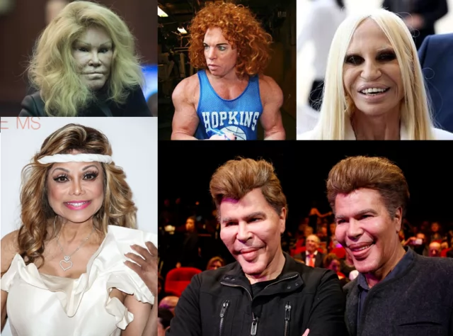 10-Celebrity-Plastic-Surgery-Disasters-You-Need-To-See.png