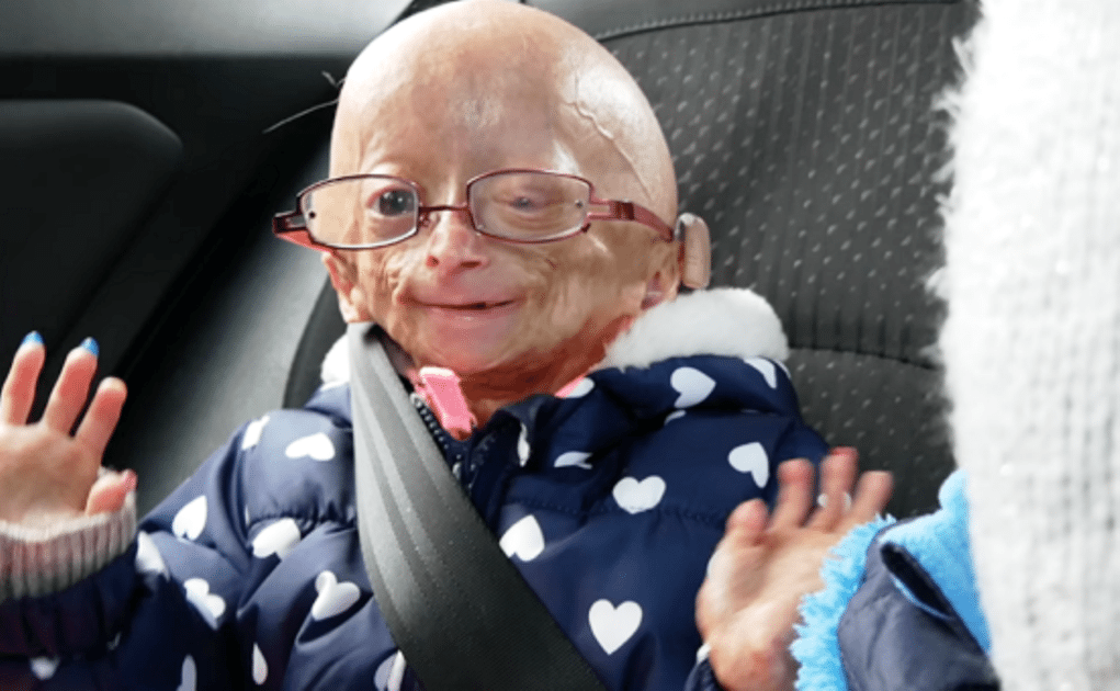 Adalia Rose Bio, Is She Dead or Alive? Here Are The Facts - Networth ...