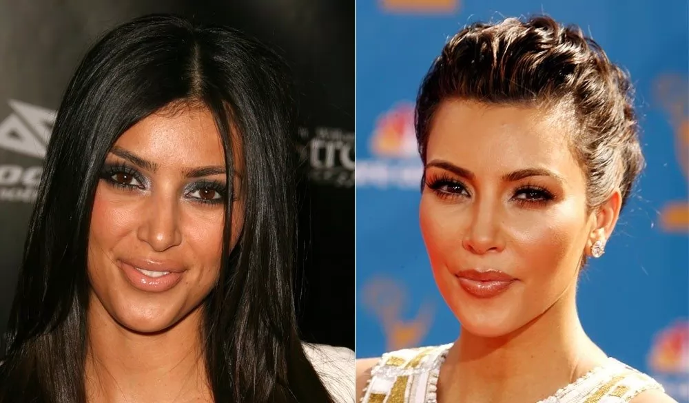 Kim Kardashian Before and After Plastic Surgery - Networth ...